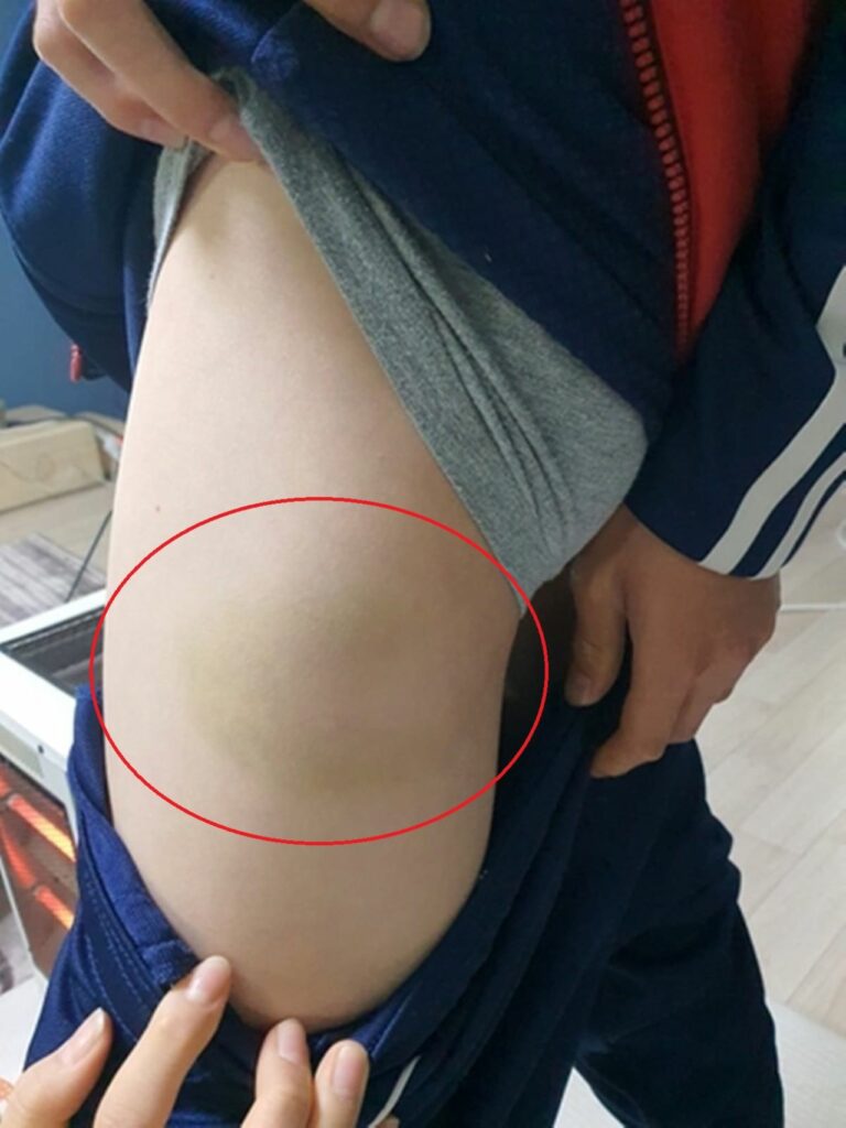 Trẻ em tại học viện bóng đá SON bị huấn luyện viên tác động vật lý